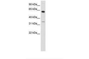 ZNF609 anticorps  (AA 71-120)