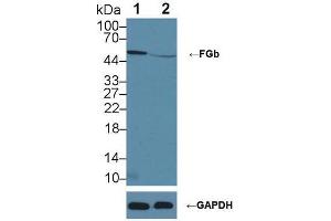 Image no. 3 for anti-Fibrinogen beta Chain (FGB) (AA 29-491) antibody (ABIN2929200)