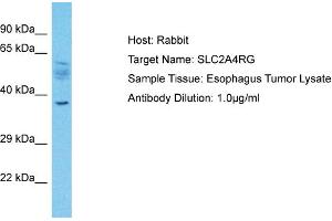 Image no. 1 for anti-SLC2A4 Regulator (SLC2A4RG) (N-Term) antibody (ABIN2781089)