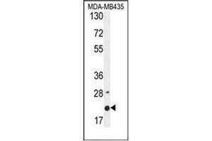 Image no. 2 for anti-Membrane-Spanning 4-Domains, Subfamily A, Member 4 (MS4A4A) (AA 40-68), (N-Term) antibody (ABIN953523)