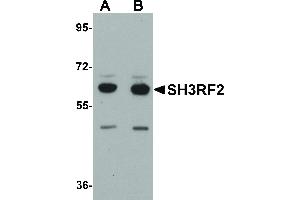 Image no. 1 for anti-SH3 Domain Containing Ring Finger 2 (SH3RF2) (C-Term) antibody (ABIN6656371)