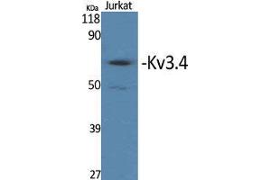 Kv3.4 antibody  (Ser676)