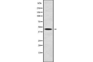 Image no. 1 for anti-Carboxypeptidase O (CPO) antibody (ABIN6261005)