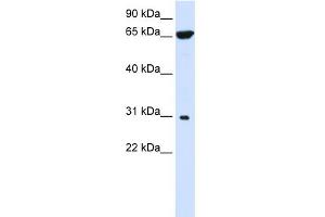 Image no. 1 for anti-Protein tyrosine Phosphatase-Like A Domain Containing 2 (PTPLAD2) (Middle Region) antibody (ABIN2781938)