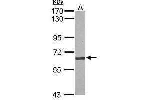 Image no. 2 for anti-Angiopoietin 2 (ANGPT2) (Center) antibody (ABIN2854898)