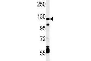 Image no. 3 for anti-Hypoxia Inducible Factor 1, alpha Subunit (Basic Helix-Loop-Helix Transcription Factor) (HIF1A) (AA 728-757) antibody (ABIN3031282)