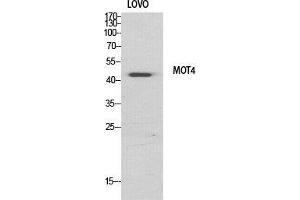 Image no. 2 for anti-Solute Carrier Family 16 (Monocarboxylic Acid Transporters), Member 3 (SLC16A3) (Internal Region) antibody (ABIN3185496)
