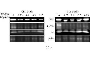 Image no. 4 for anti-PTK2 Protein tyrosine Kinase 2 (PTK2) (C-Term) antibody (ABIN2854860)