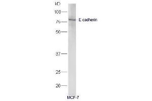 Image no. 4 for anti-Cadherin 1, Type 1, E-Cadherin (Epithelial) (CDH1) (AA 401-500) antibody (ABIN1387847)