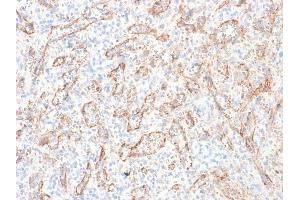 Image no. 4 for anti-Tumor Necrosis Factor (Ligand) Superfamily, Member 15 (TNFSF15) antibody (ABIN6941290)