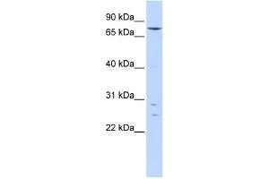 Image no. 1 for anti-Kelch-Like 4 (KLHL4) (N-Term) antibody (ABIN2781084)