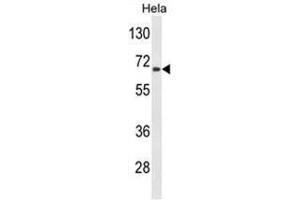 Western blot analysis of AGXT2 Antibody (C-term) in Hela cell line lysates (35 µg/lane).
