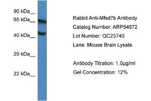 Image no. 1 for anti-Feline Leukemia Virus Subgroup C Cellular Receptor 1 (FLVCR1) (Middle Region) antibody (ABIN2785982)