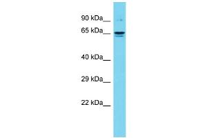 Image no. 1 for anti-Deltex Homolog 4 (Drosophila) (DTX4) (C-Term) antibody (ABIN2791002)