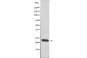 Image no. 1 for anti-Ephrin A2 (EFNA2) (N-Term) antibody (ABIN6257170)