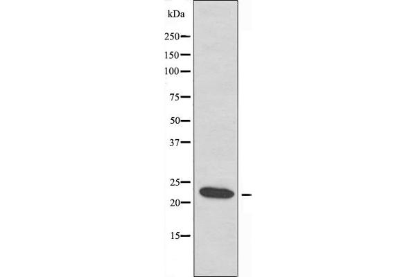 anti-Ephrin A2 (EFNA2) (N-Term) antibody