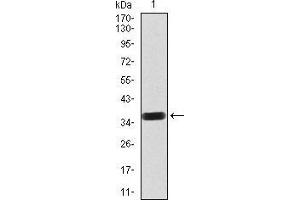 Western blot analysis using PDGFRB mAb against human PDGFRB (AA: 33-133) recombinant protein.