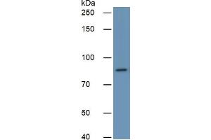 Image no. 2 for Phospholipase A2-Activating Protein (PLAA) ELISA Kit (ABIN6730908)