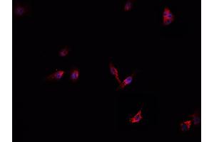 Image no. 4 for anti-Complement Factor B (CFB) (Internal Region) antibody (ABIN6260775)