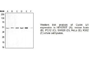 Image no. 1 for anti-Cyclin E1 (CCNE1) (Center) antibody (ABIN2487035)
