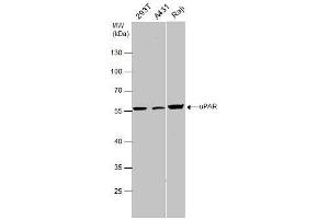 WB Image uPAR antibody detects uPAR protein by western blot analysis.