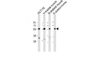 Image no. 3 for anti-Tripartite Motif Containing 72 (TRIM72) (AA 299-327), (C-Term) antibody (ABIN655919)