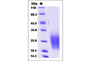 Image no. 1 for Tetraspanin 7 (TSPAN7) (AA 113-213) protein (His tag) (ABIN2010036)