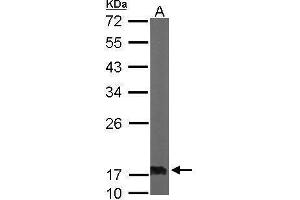 Image no. 1 for anti-Nucleoside diphosphate kinase B (NME2) (Center) antibody (ABIN2854347)