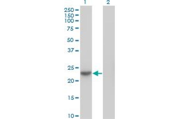 anti-NME/NM23 Nucleoside Diphosphate Kinase 6 (NME6) (AA 1-194) antibody