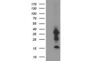 Image no. 1 for anti-PDZ and LIM Domain 2 (PDLIM2) antibody (ABIN1500128)