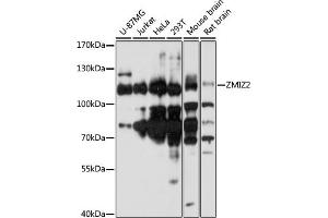 ZMIZ2 抗体  (AA 1-110)