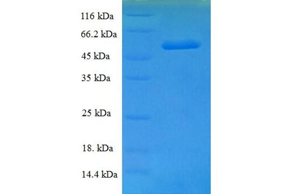 TXNL1 Protein (AA 2-289) (His-SUMO Tag)
