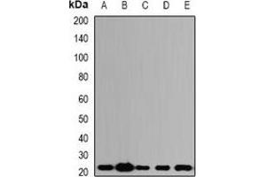 Image no. 2 for anti-Asparagine-Linked Glycosylation 2, alpha-1,3-Mannosyltransferase Homolog (ALG2) antibody (ABIN2966405)