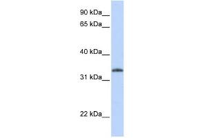 Image no. 1 for anti-Uridine-Cytidine Kinase 2 (UCK2) (N-Term) antibody (ABIN2782530)