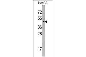 Image no. 1 for anti-Sorting Nexin 6 (SNX6) (AA 81-110), (N-Term) antibody (ABIN5532129)