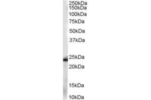 Image no. 1 for anti-Chromosome 11 Open Reading Frame 82 (C11orf82) (C-Term) antibody (ABIN2789390)
