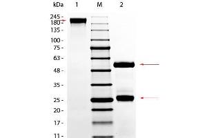 SDS-PAGE (SDS) image for gamma Globulin Fraction protein (ABIN964144)