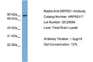 Image no. 2 for anti-DEP Domain Containing 1 (DEPDC1) (Middle Region) antibody (ABIN2786635)