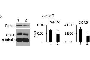Image no. 13 for anti-Poly (ADP-Ribose) Polymerase 1 (PARP1) (Center) antibody (ABIN2854798)