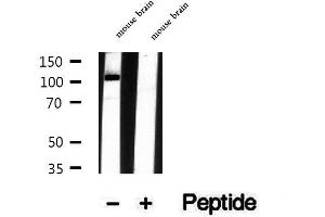 anti-Ubiquitin Specific Peptidase 33 (USP33) (Internal Region) antibody