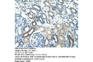 Image no. 1 for anti-Pregnancy Specific beta-1-Glycoprotein 3 (PSG3) (N-Term) antibody (ABIN2775484)