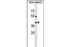 PRRT2 antibody  (AA 207-233)
