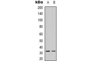 Image no. 1 for anti-Alkaline Ceramidase 3 (ACER3) (Center) antibody (ABIN3066603)
