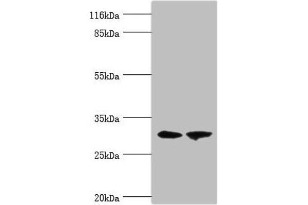 ACBD4 antibody  (AA 1-305)