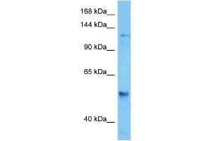 Image no. 3 for anti-Histone Deacetylase 6 (HDAC6) (C-Term) antibody (ABIN2780739)