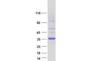 Image no. 1 for Dehydrogenase/reductase (SDR Family) Member 9 (DHRS9) (Transcript Variant 3) protein (Myc-DYKDDDDK Tag) (ABIN2719454)
