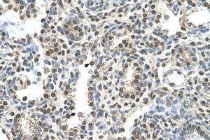 Image no. 1 for anti-Melanoma Antigen Family A, 8 (MAGEA8) (AA 51-100) antibody (ABIN6736631)