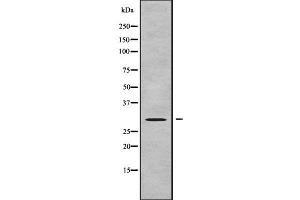 anti-Gem (Nuclear Organelle) Associated Protein 8 (GEMIN8) (C-Term) antibody