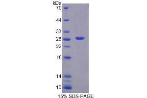 Image no. 1 for BCL2-Associated Athanogene (BAG1) (AA 174-355) protein (His tag) (ABIN6239681)