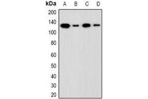 Image no. 2 for anti-Activity-Dependent Neuroprotector Homeobox (ADNP) (N-Term) antibody (ABIN3222810)